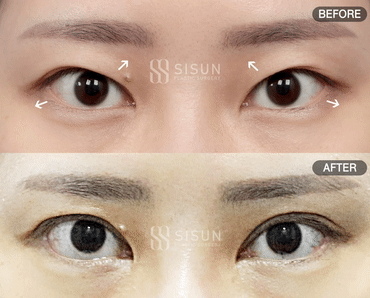 61ddfa18be7217ccfd69a83cf8f7c50c_1747640510_3561.gif