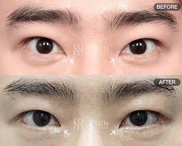 61ddfa18be7217ccfd69a83cf8f7c50c_1747640511_3313.gif