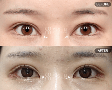61ddfa18be7217ccfd69a83cf8f7c50c_1747640513_285.gif