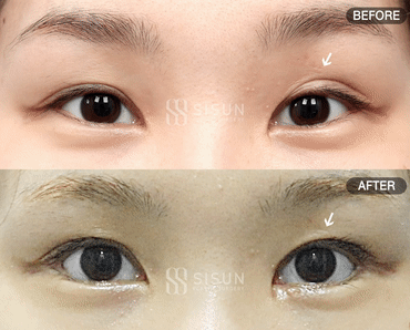 61ddfa18be7217ccfd69a83cf8f7c50c_1747640521_4663.gif