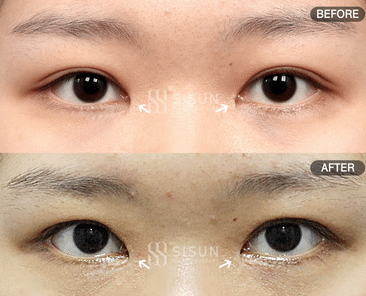 920a22b0d2647103aeea6799d2d88b05_1748421727_4934.gif