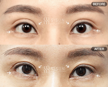 920a22b0d2647103aeea6799d2d88b05_1748421980_9253.gif