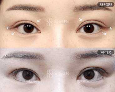 920a22b0d2647103aeea6799d2d88b05_1748421982_9994.gif