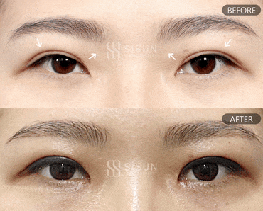 920a22b0d2647103aeea6799d2d88b05_1748421985_8002.gif