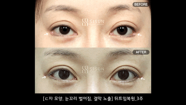 ced9401ea5d41576bb71d81142fcb87f_1746091591_9869.gif