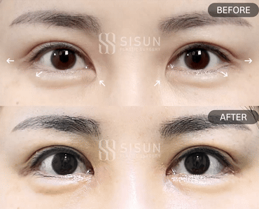 ced9401ea5d41576bb71d81142fcb87f_1746514961_6688.gif
