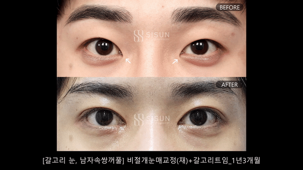 ced9401ea5d41576bb71d81142fcb87f_1746607860_4732.gif
