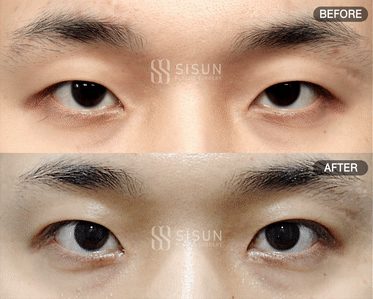 ea6b64573a42586a814835fb1a70bcf0_1747907292_7087.gif