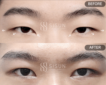 ea6b64573a42586a814835fb1a70bcf0_1747907300_7183.gif