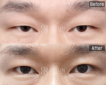 ea6b64573a42586a814835fb1a70bcf0_1747907353_71.gif
