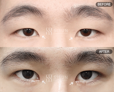 ea6b64573a42586a814835fb1a70bcf0_1747907359_6016.gif