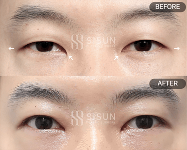 ea6b64573a42586a814835fb1a70bcf0_1747907372_2947.gif