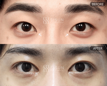 ea6b64573a42586a814835fb1a70bcf0_1747907429_9276.gif
