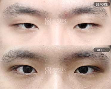 ea6b64573a42586a814835fb1a70bcf0_1747907570_7599.gif