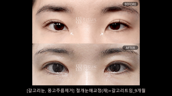 f9b333b251cb15313509d3b15bc2ed4f_1750239116_4155.gif