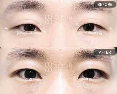 54fe7b2705e6d4745b5924fc7f2476f6_1751621343_4858.gif