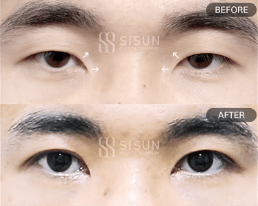593c9bdd03add2d89ef0ab4b8833563f_1752051327_7451.gif