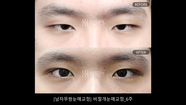 593c9bdd03add2d89ef0ab4b8833563f_1752051352_2928.gif