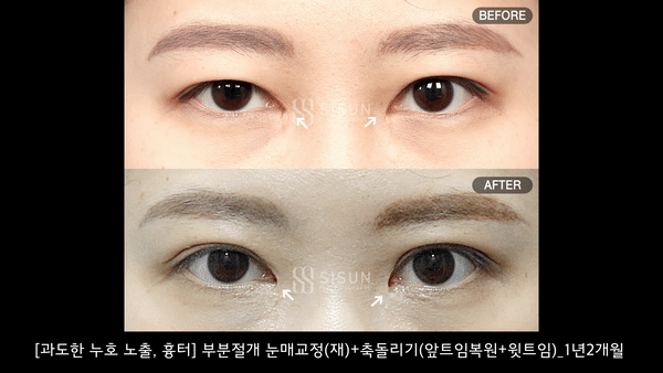 6c3eb92ec3a9036098eb32a48f4e3cb8_1753691483_9623.gif