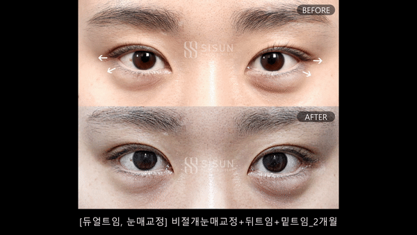 ac7dde493436793cb4004fb0279d017c_1753262839_2205.gif
