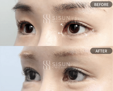 2ad99256bcb238e399155e960fd50f0a_1755681067_311.gif