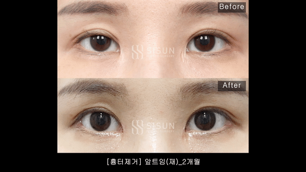 2ad99256bcb238e399155e960fd50f0a_1755681080_5411.gif