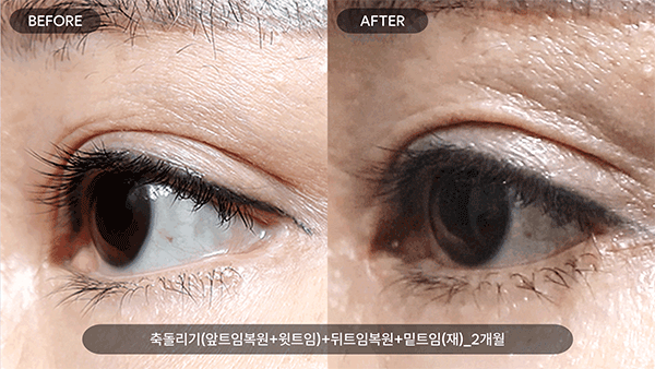 2ad99256bcb238e399155e960fd50f0a_1755681088_5482.gif