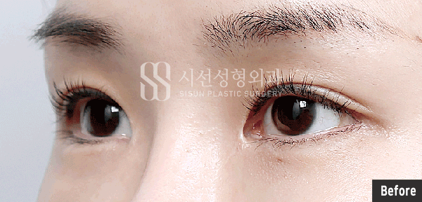 2ad99256bcb238e399155e960fd50f0a_1755681114_4641.gif