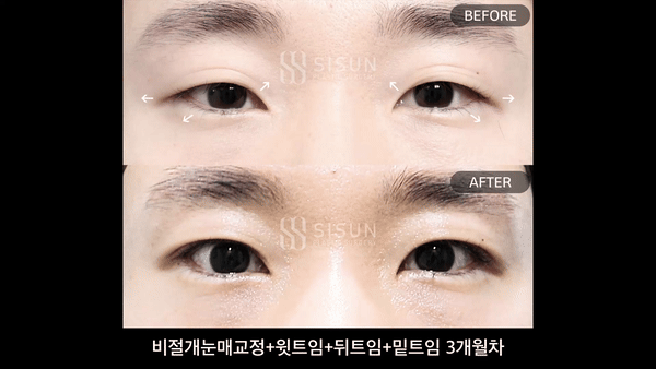 356deb1d2002ceb1699bafb6c5dab992_1756200950_0832.gif
