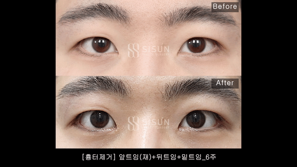 356deb1d2002ceb1699bafb6c5dab992_1756200951_0549.gif