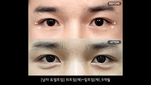 356deb1d2002ceb1699bafb6c5dab992_1756200960_7338.gif