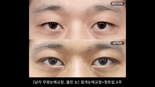 4e3eee6a6702e4f29ed7760c5aecd966_1754473521_6405.gif