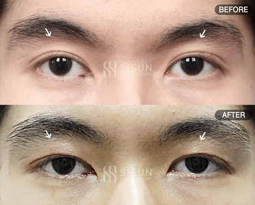 508251a6b2e4e24fbe3339d496fce759_1754964231_7007.gif