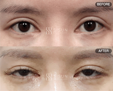 508251a6b2e4e24fbe3339d496fce759_1754964311_5218.gif
