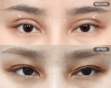 508251a6b2e4e24fbe3339d496fce759_1754964373_8706.gif