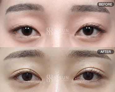 8ef88af1b83a7fba97f7fb5d828adfb1_1756458140_0225.gif