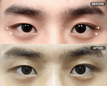 8ef88af1b83a7fba97f7fb5d828adfb1_1756458862_4772.gif