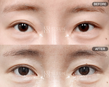 8ef88af1b83a7fba97f7fb5d828adfb1_1756458890_0201.gif