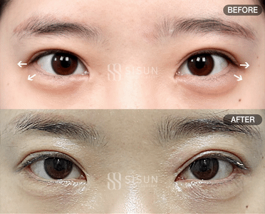 8ef88af1b83a7fba97f7fb5d828adfb1_1756459374_8257.gif