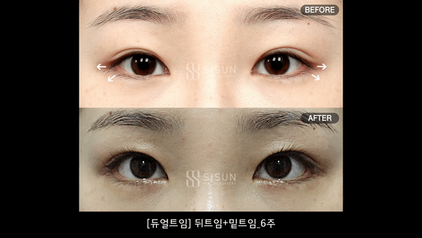 bb4de13d74dd27fc7916630ec4929cc6_1756285460_9777.gif