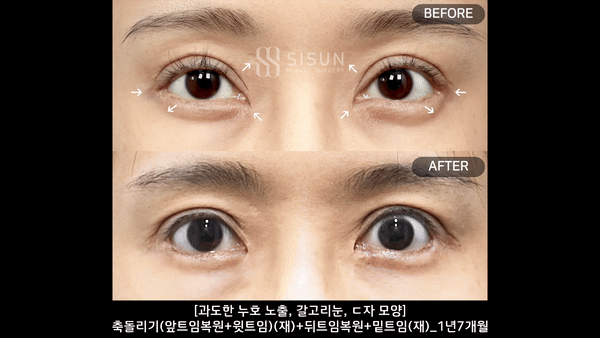 ecfb46b6cb57b51789b62478698232f5_1757668912_2508.gif