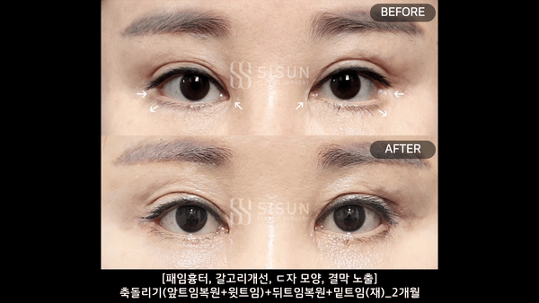 ecfb46b6cb57b51789b62478698232f5_1757668912_9323.gif