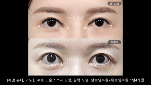 ecfb46b6cb57b51789b62478698232f5_1757668917_1154.gif