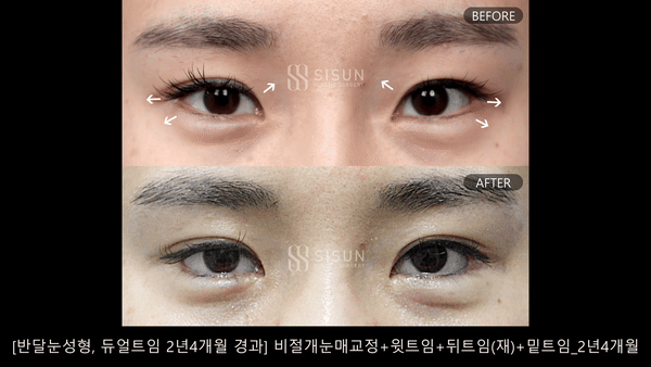 f421a242eaadca559fb13dc1047db5fd_1757896106_7187.gif