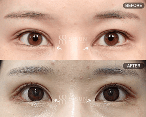1e899acb0879a89689801eaa30cc7465_1761296376_3669.gif