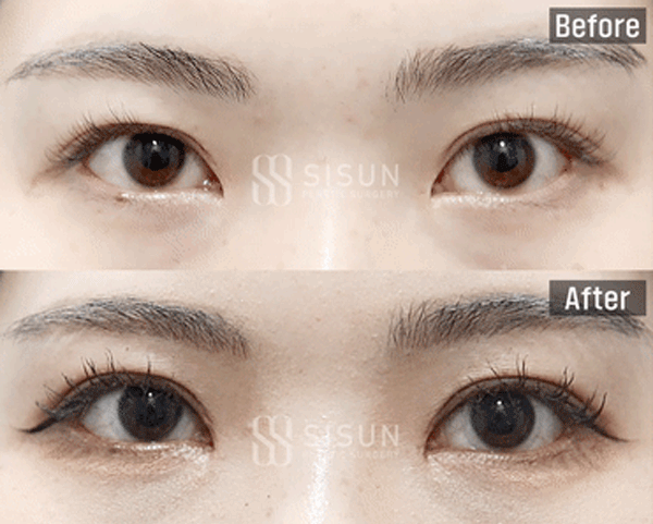 1e899acb0879a89689801eaa30cc7465_1761296968_4542.gif