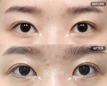 936d9bbc25ee1b4fb272c60b09bd8b18_1760348587_1712.gif