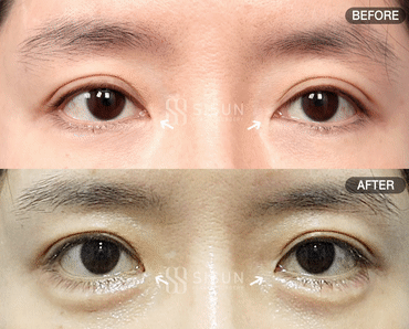936d9bbc25ee1b4fb272c60b09bd8b18_1760348942_9491.gif