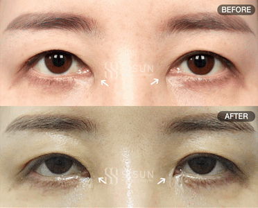 936d9bbc25ee1b4fb272c60b09bd8b18_1760349128_3723.gif