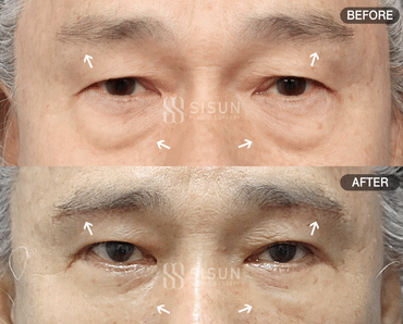 955da93eeeb04d9ebe691c4f9ce1bfab_1761111478_5751.gif